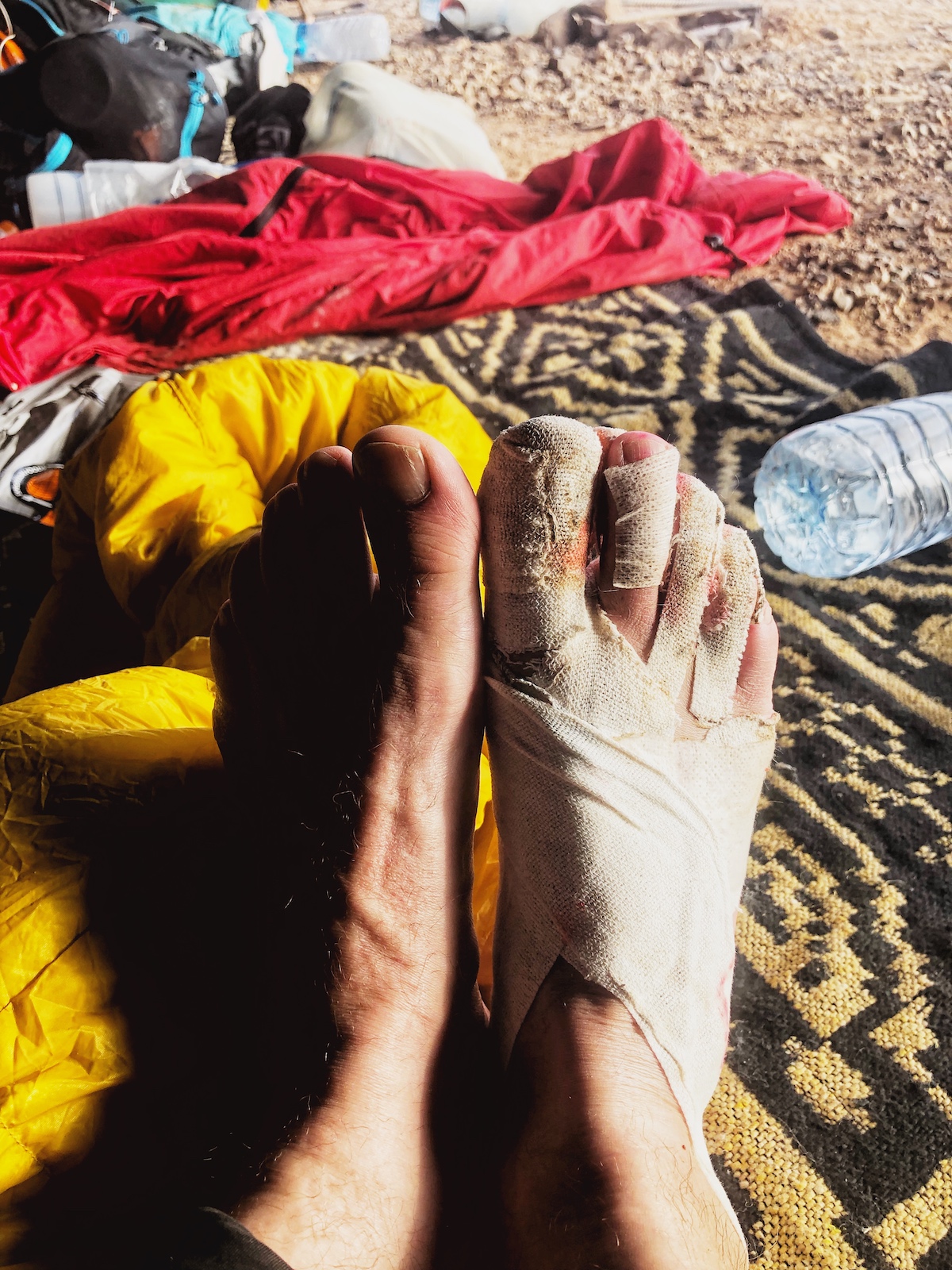 Marathon Des Sables Review: 6 Marathon/6 Days in The Sahara! | Feet Marathon Des Sables My feet during Marathon des Sables