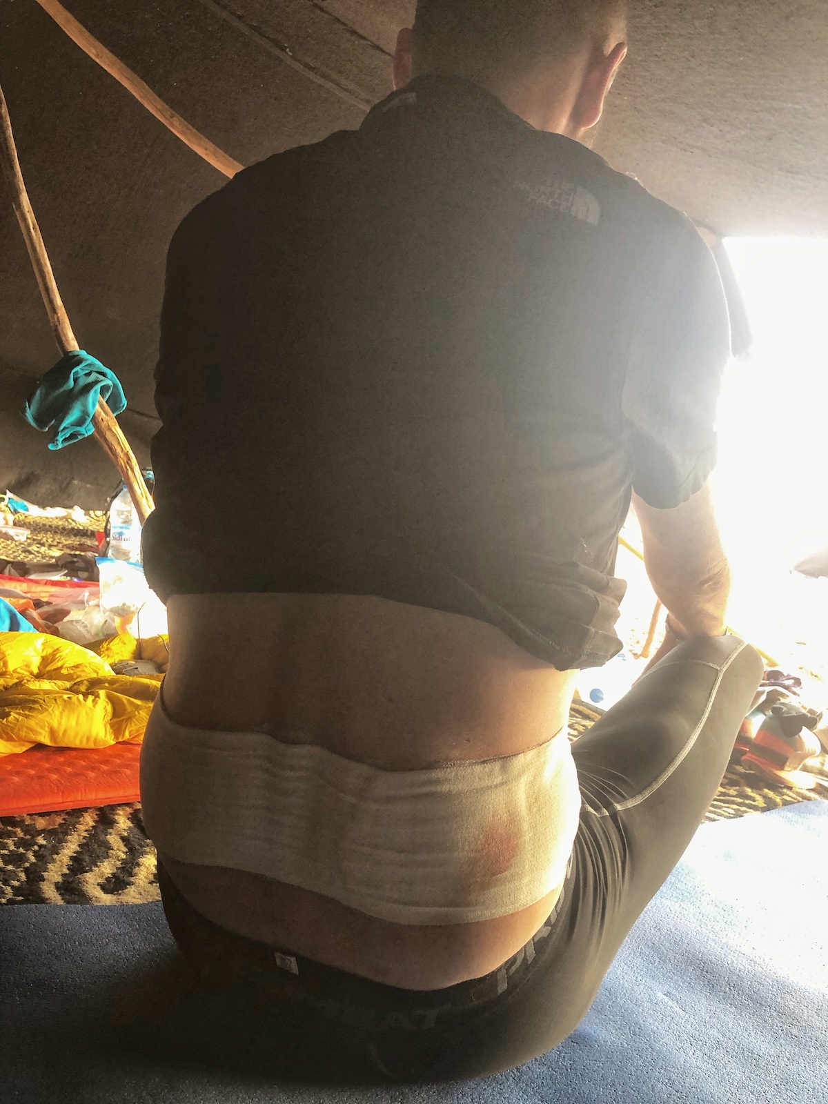 Marathon Des Sables Review: 6 Marathon/6 Days in The Sahara! | Injury Marathon Des Sables My back after day 1 of Marathon des Sables